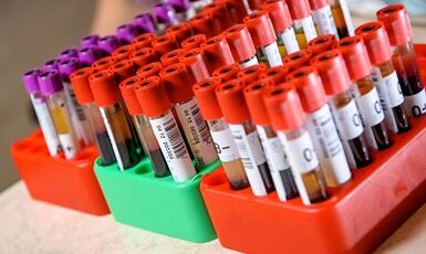 diet untuk penurunan berat badan mengikut jenis darah